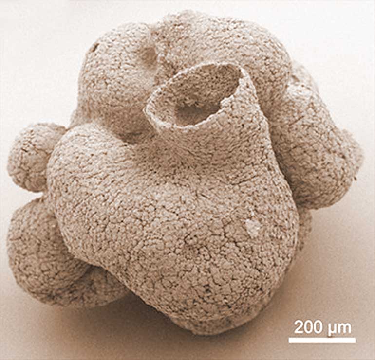Scanning electronic microscope picture of the 600 million-year-old sponge-like fossil