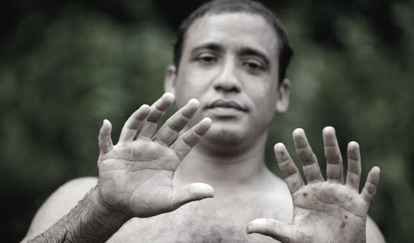 Yoandri Hernandez Garrido shows off his six-fingered hands