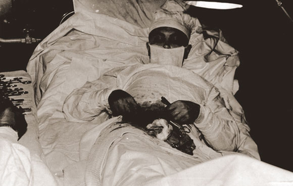1961, Soviet surgeon removes his own Appendix
